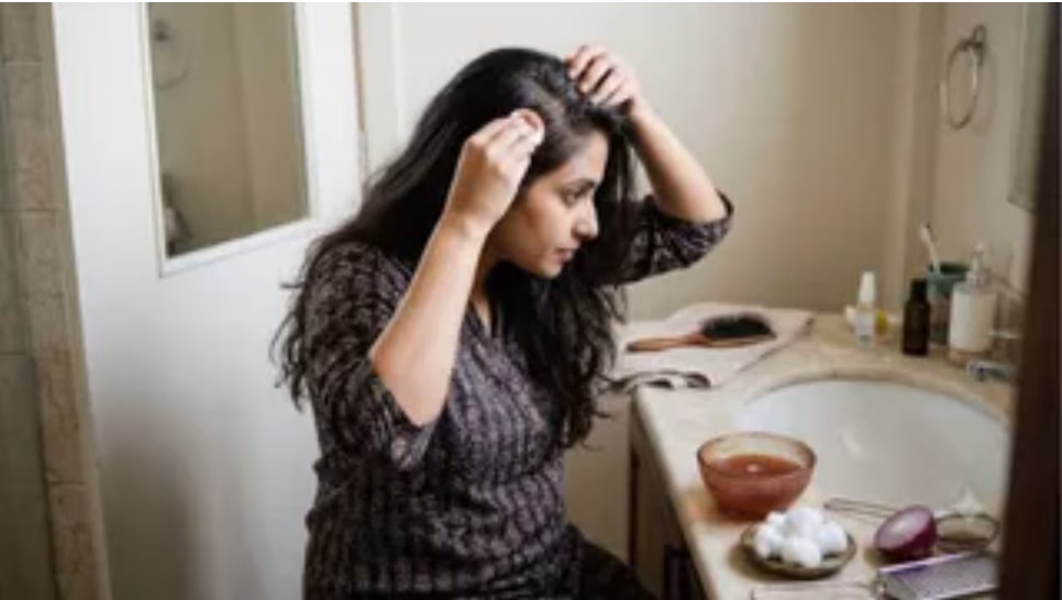 सर्दियों में डैंड्रफ से है परेशान? प्याज के इन घरेलू उपायों से पाएं छुटकारा